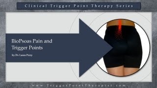 IlioPsoas Pain and Trigger Points [upl. by Scarito]