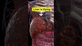 Liver is Dying health healthtips shorts [upl. by Eilagam362]