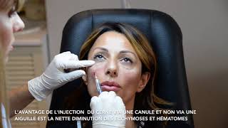 Traitement des cernes par injection dacide hyaluronique [upl. by Adorne]