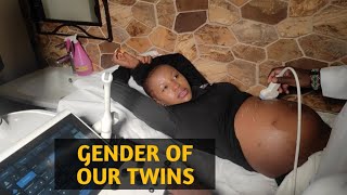 KNOWING GENDER OF OUR MONO MONO TWINS  SECOND ULTRASOUND APPOINTMENT [upl. by Sidras]