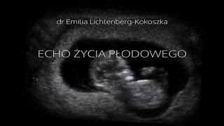 Dobry nastrój  dr Emilia LichtenbergKokoszka [upl. by Yralih33]