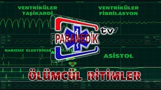 EKG  KARDİYAK ARREST  Ölümcül Ritimler Hangileridir [upl. by Thurston]