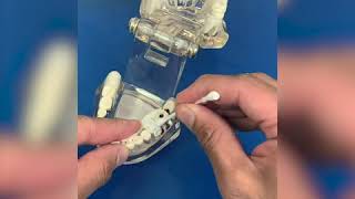 How to use temporary dental filling material [upl. by Abshier]