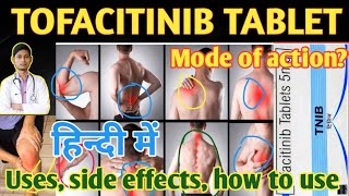 Tofacitinib 5 mg tablet uses side effects how to use in hindi tofacitinib [upl. by Altheta]