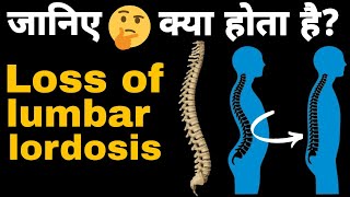 loss of lumbar Lordosis kya hota haiलंबर लोर्डोसिस क्या होता है।कमर दर्द का कारण।lordosisbackpain [upl. by Viccora832]