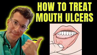 How to recognise and treat Mouth Ulcers getting rid of canker sores  Doctor ODonovan explains [upl. by Glarum]