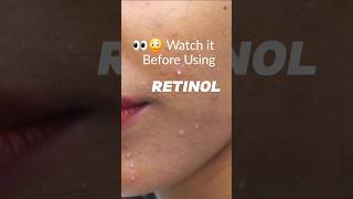 RetinolThe Ugly Truth you must know shorts retinol skincare retinal fyp beginnerfriendly [upl. by Aubert]