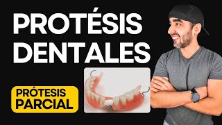 Que son las Prótesis Dentales Removibles Acrílicas [upl. by Neville]