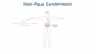 Non Polio Enteroviruses  Echovirus Coxsackievirus and Enterovirus [upl. by Sirama]