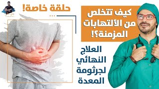 علاج جرثومة المعده الفعالالتخلص من الالتهابات المزمنة وبدون أدوية [upl. by Ajat]