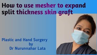 How to use mesher to expand split thickness skin graft [upl. by Frey]