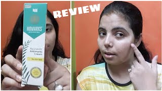 NOMARKS Ayurvedic Antimarks Cream Review  For Oily Skin  Good Product [upl. by Lleneg68]