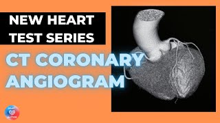 What is a CT Coronary Angiogram  CTCA [upl. by Atal]