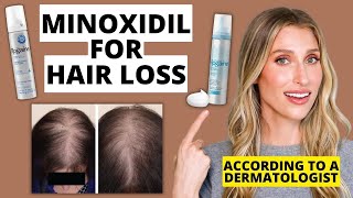 Dermatologist Explains How Minoxidil Works for Hair Loss How to Use Results amp More [upl. by Sehcaep]