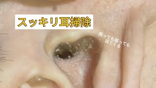 【耳掃除part6】1週間ぶりの耳掃除！綺麗になりました！※所々ピンボケしている部分があります。すみませんTT [upl. by Giacinta]