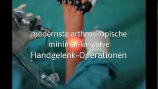 ARTHROSKOPISCHE HANDGELENK OPERATION minimal invasive Handgelenksoperation Handgelenk Op [upl. by Towland]