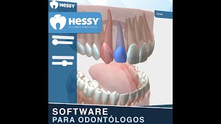 👤 Paciente  1 🦷Odontogramas  Hessy® Software Dental [upl. by Jessi]