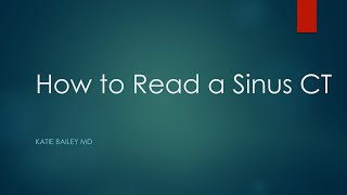 How to read a Sinus CT [upl. by Suiremed43]