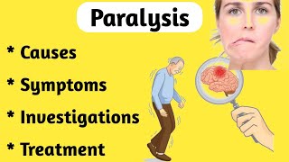 Paralysis Causes Symptoms and Treatment [upl. by Khajeh]