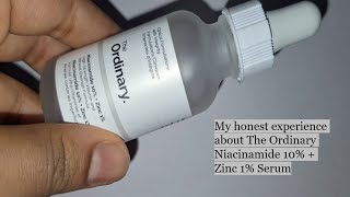 My Honest Experience of The Ordinary Niacinamide 10  Zinc 1 Serum  Does It Really Work [upl. by Nnylak]