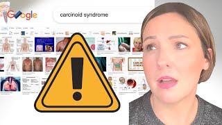 CARCINOID SYNDROME  Erythrophobia flushed skin chronic blushing  DO NOT GOOGLE [upl. by Adriano]