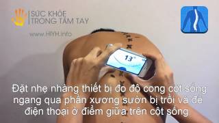 Thước đo cong vẹo cột sống  CÁCH SỬ DỤNG [upl. by Mollee]