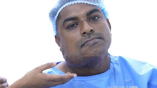 Large Hemangioma Removal Procedure for Young Man  Dr Sunil Richardson [upl. by Jonathon]