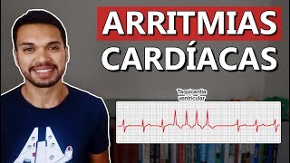 Arritmias Cardíacas Cardio 07 [upl. by Errehs912]