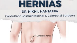 👨‍⚕️ Hernia Alert Is that bulge more than it seems [upl. by Ayimat]