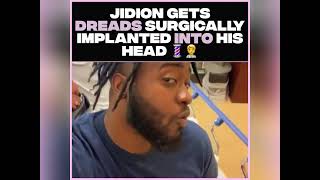 Jidion Gets Dreads 😱 Surgucally Implanted [upl. by Nashner]