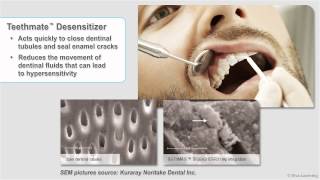 Teethmate Desensitizer [upl. by Meter]