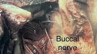 BUCCINATOR MUSCLE IN ENT [upl. by Ambrose]