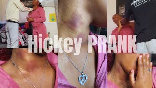 Hickey Prank On My Protective boyfriend got heated [upl. by Aihcropal112]