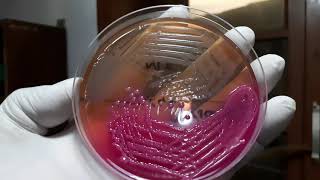 Klebsiella and Pseudomonas colony characteristics on Macconkey agar Demonstration [upl. by Mason587]