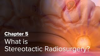 What is Stereotactic Radiosurgery Chapter 5 — Brain Metastases A Documentary [upl. by Corron]