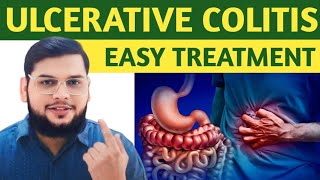 Ulcerative Colitis Treatment  Ulcerative Colitis Symptoms  Dr Saad Ahmed [upl. by Guinna262]