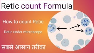 Retic count formula [upl. by Bouchard414]