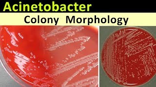 Acinetobacter Colony Morphology [upl. by Sadnalor201]