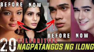 Di mo aakalaing mga PANGO pala sila noon  FILIPINO CELEBRITIES NA NAGPATANGOS NG ILONG [upl. by Akinajnat]