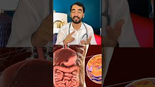 What is h pylori and its treatment 🤔 dradnankhan duet indianmusic adnankhan [upl. by Goddart591]