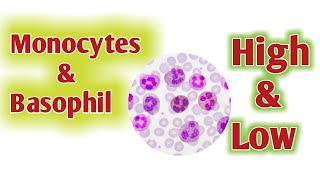 Monocytes High  Basophil High [upl. by Ulrike]