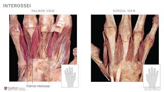 Anatomy of the Upper Limb Interossei and Lumbricals [upl. by Annadroj]