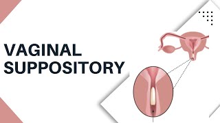 Vaginal Suppository Insertion  How to put It Safely and Easily [upl. by Melena]