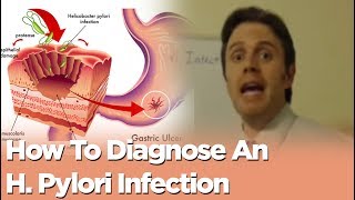 How To Diagnose An H Pylori Infection [upl. by Eisenhart934]