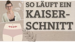 Was passiert bei einem Kaiserschnitt Wie läuft er ab Ich erkläre dir die Geburt per Kaiserschnitt [upl. by Gisele]