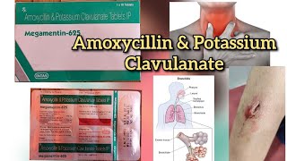 घाव लगातार खांसी Megamentin 625 tablet uses in hindi  Amoxycillin amp Potassium Clavulanate tablet [upl. by Nylg582]