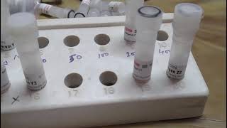 ODD methodOuchterlony Double diffusion practical method [upl. by Staffan]