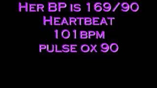 Heartbeat of 31 years old Female on Medications [upl. by Kosaka]