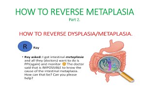 Metaplasia dysplasia How to reverse dysplasia metaplasia Causes of metaplasia [upl. by Adnesor7]