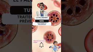 Comprendre et Prévenir le Paludisme  Guide pour les Infirmiers ide tutorial nurse paludisme [upl. by Oinotnaocram302]